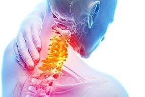 Síntomas de osteocondrosis de cuello y reglas nutricionales para enfermedades