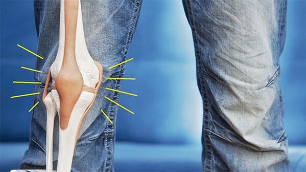 Dolor en la articulación de la rodilla.