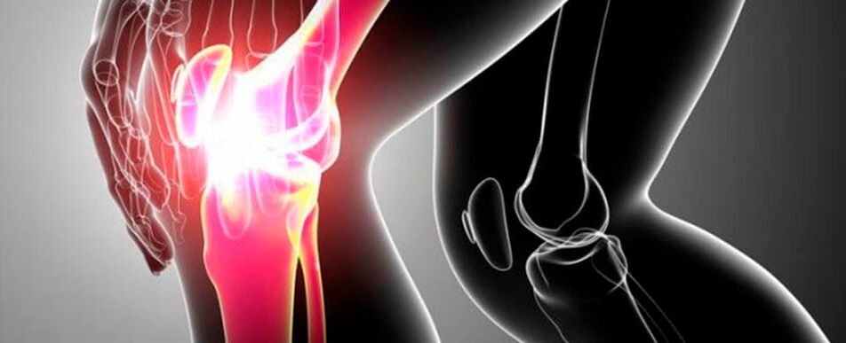Dolor en la articulación de la rodilla foto 4.